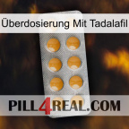Überdosierung Mit Tadalafil levitra1